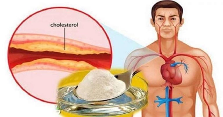 Geriausias natūralus vaistas nuo cholesterolio ir aukšto kraujo spaudimo!